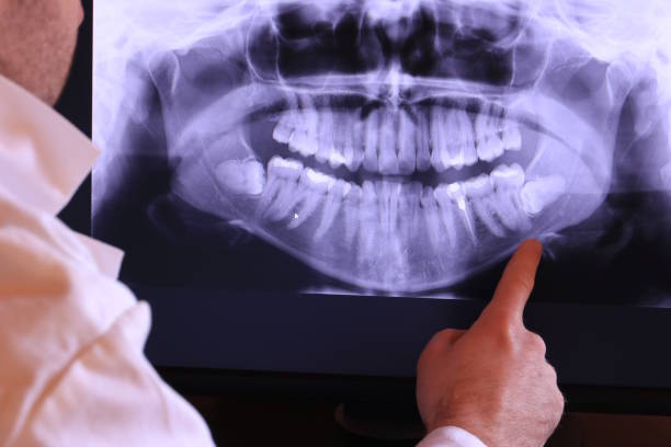 Best Broken or Cracked Tooth Emergency Dentist in El Lago, TX