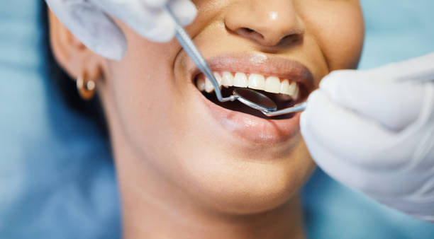 Best Emergency Dental Services for Seniors in El Lago, TX